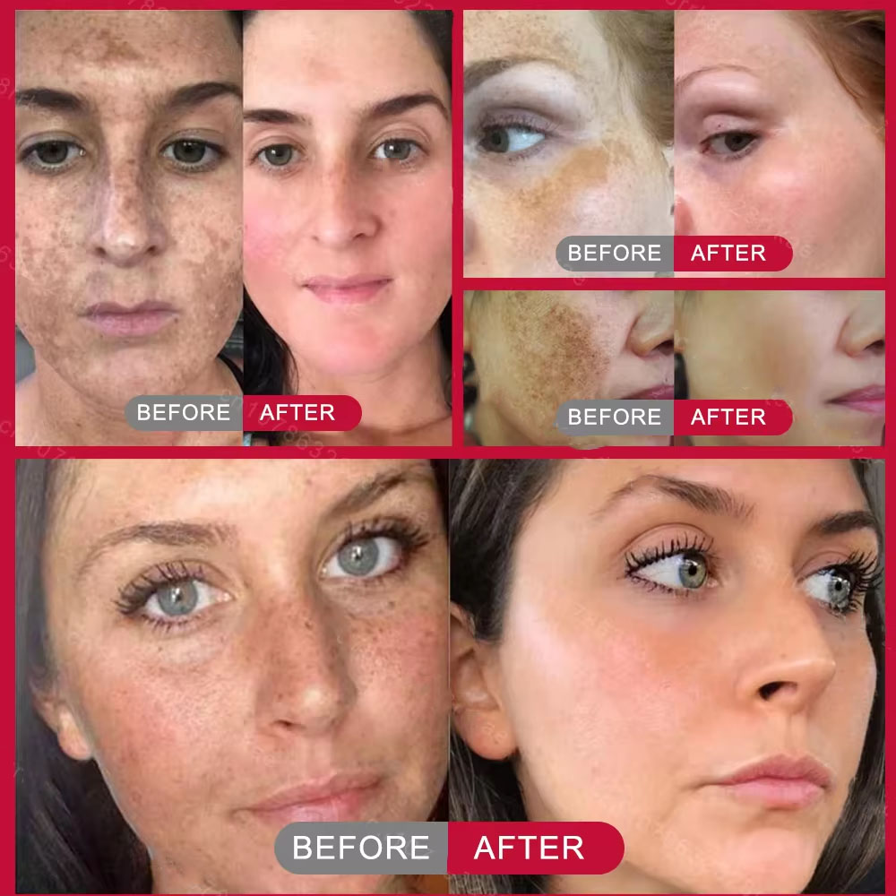 Powerful Spot-removing Whiteni - Skincare Vitamin C 评论和价格