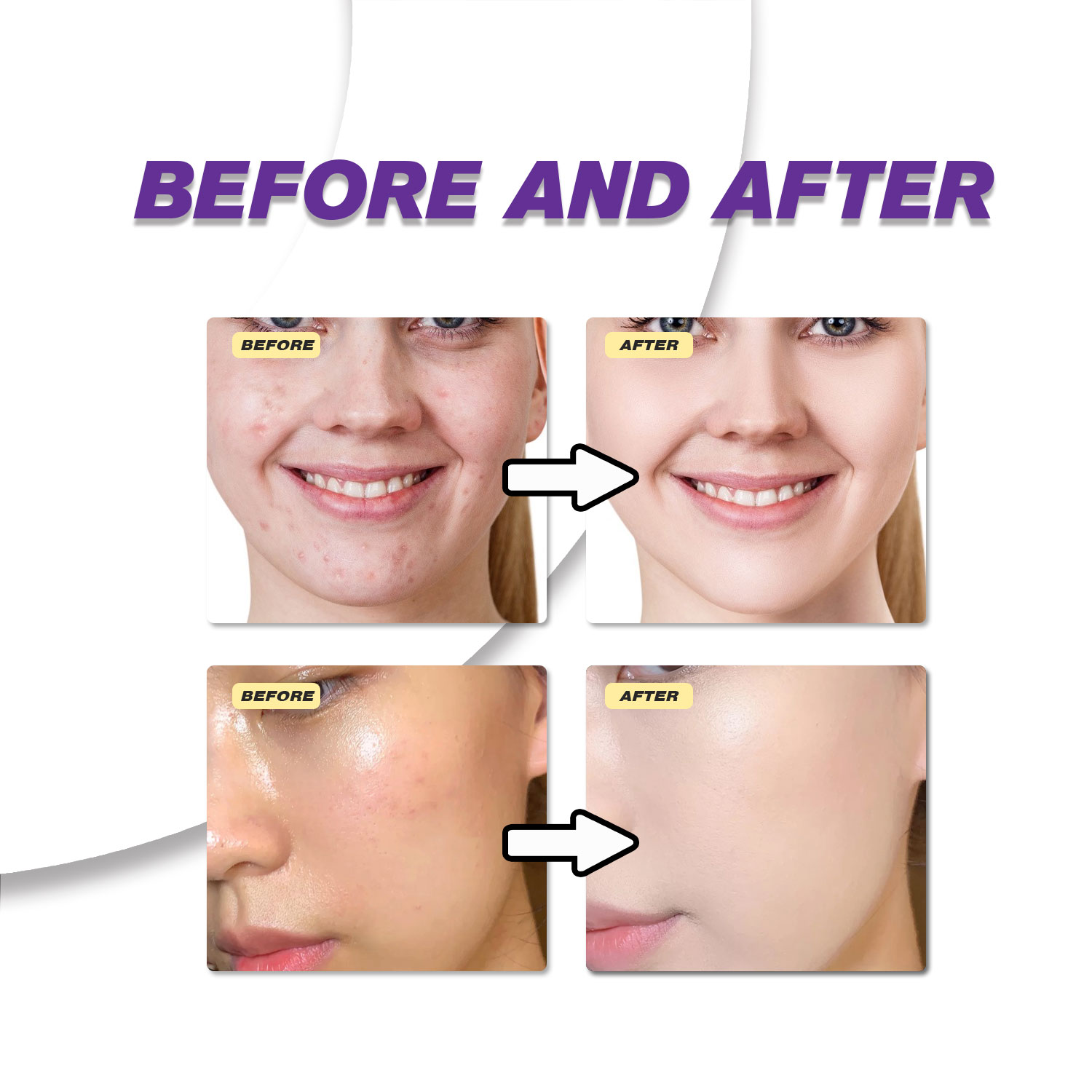 Mild Azelaic Acid Cream Improv - Azelaic Acid Serum 评论和价格