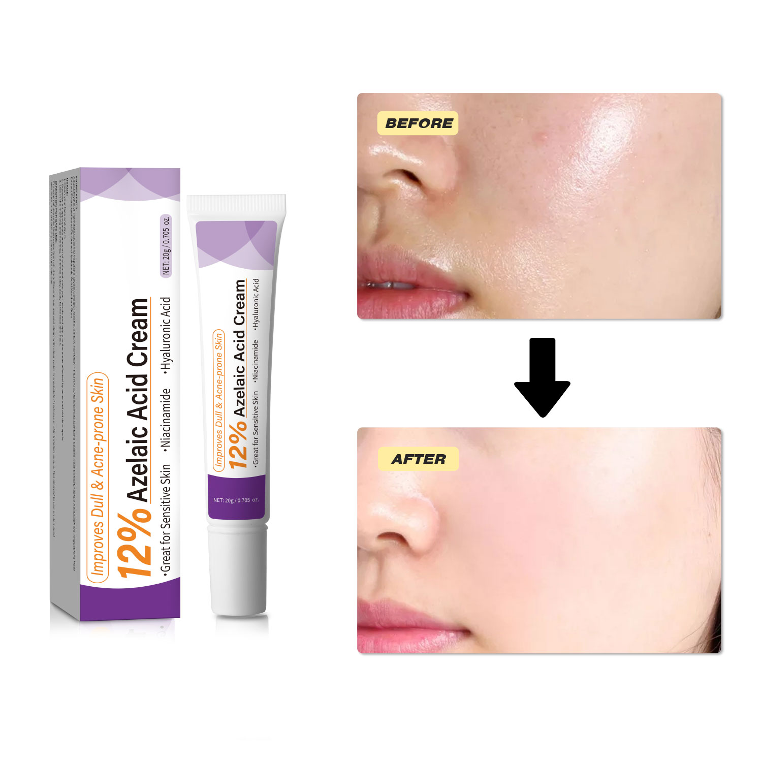 Mild Azelaic Acid Cream Improv - Azelaic Acid Serum 评论和价格